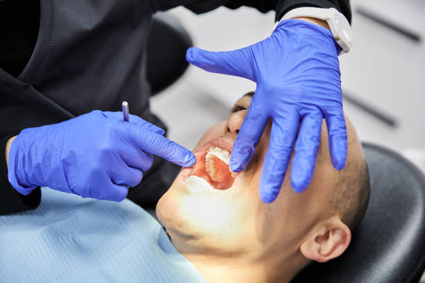 Best Emergency Treatment for Dental Infections or Abscesses in Sea Isle City, NJ